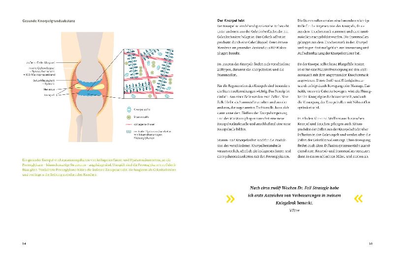 Produktbild: Arthrose endlich heilen